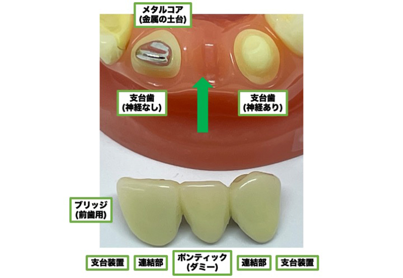 ブリッジの各パーツ