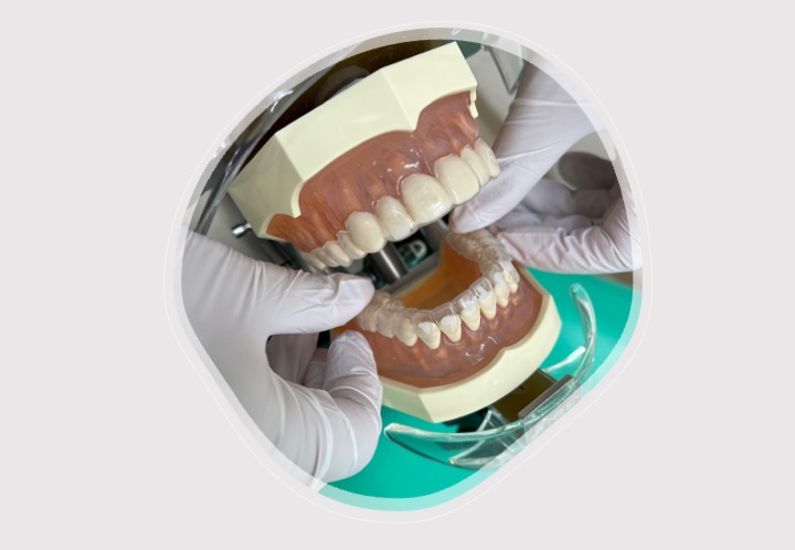 新たに入れ歯を作る場合またはリラインを行う場合の前に粘膜調整というものを行うことがあります