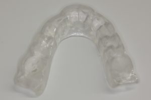 歯ぎしりに対するマウスガードの例