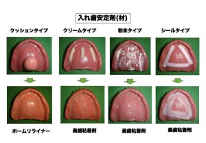 入れ歯安定剤 入れ歯　