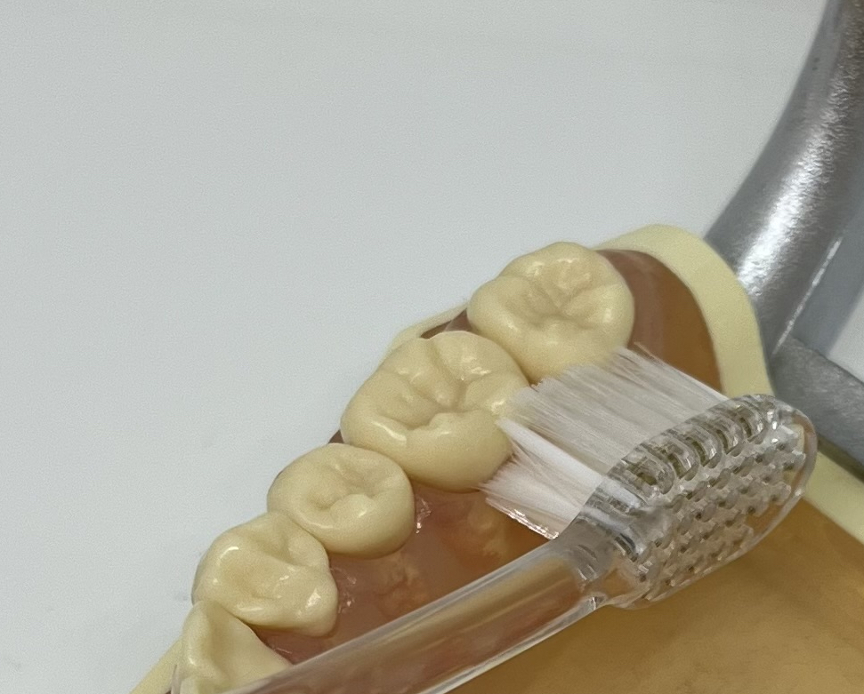 歯周病予防/むし歯予防: 奥歯の内側、歯ブラシで磨きにくいですよね
