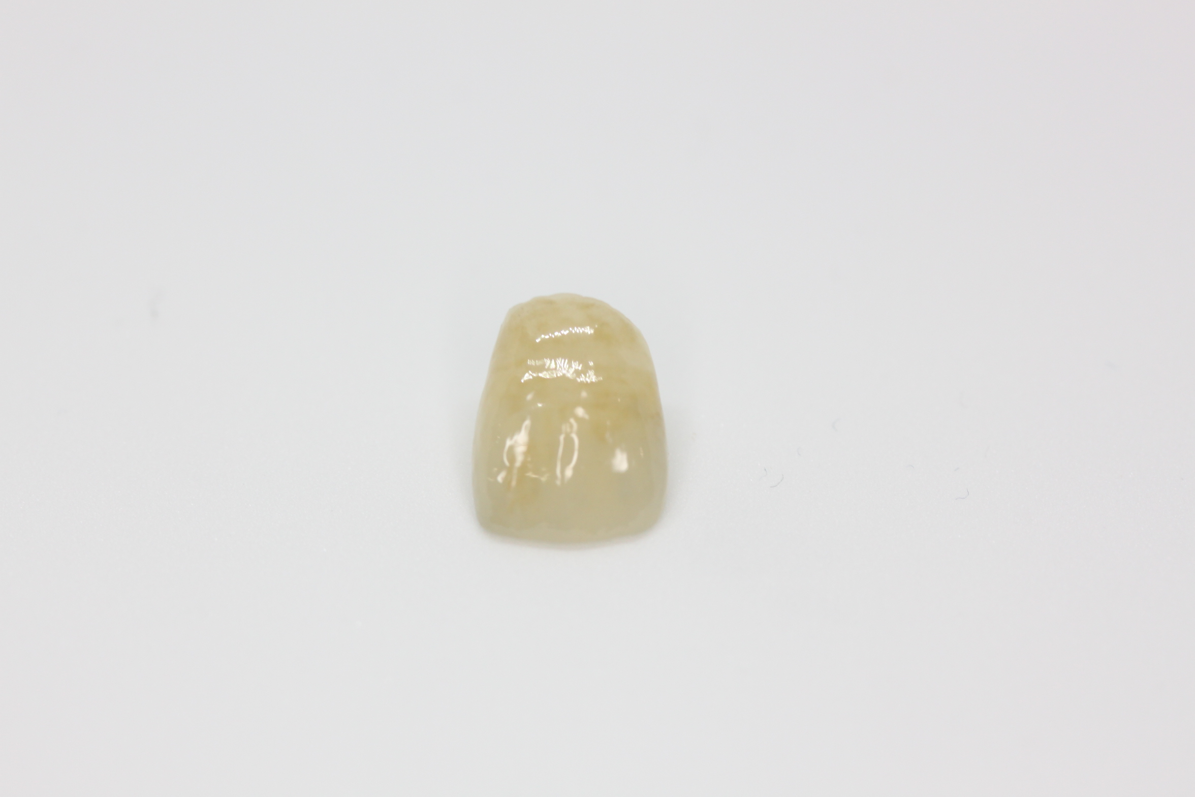 審美歯科—–セラミックでできた歯のような差し歯