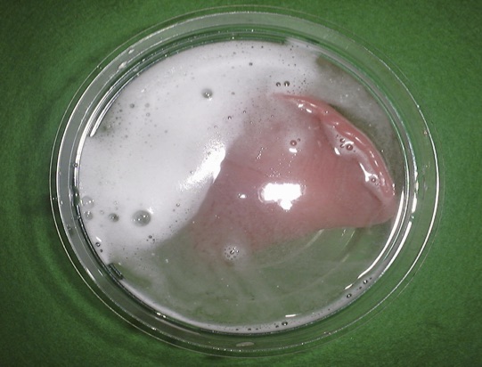 入れ歯の汚れは身体にさまざまな炎症を引き起こします　細菌の繁殖を防ぎましょう！ 入れ歯洗浄剤が役に立ちます